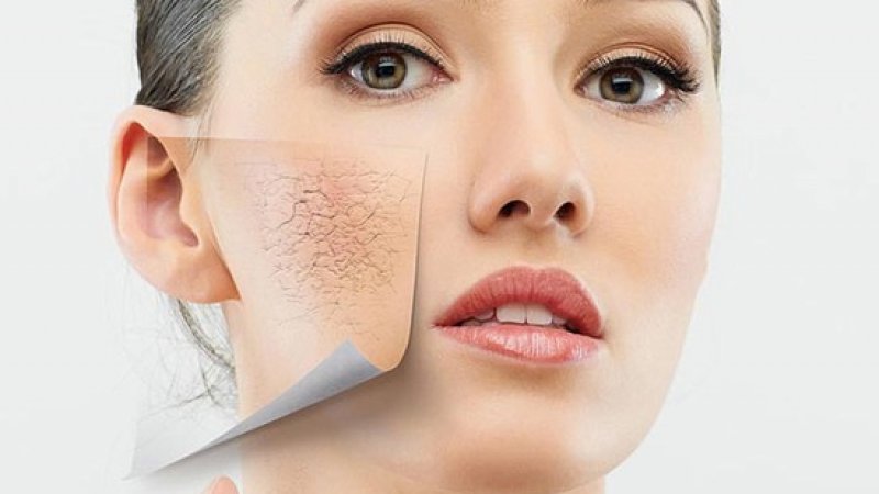 cách chăm sóc da bị lão hóa
