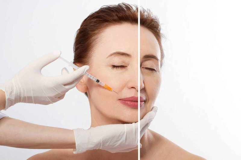 cách chăm sóc da mặt bị rỗ